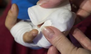 Read more about the article Finger Sprains in Walking Football