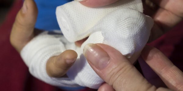 Finger Sprains in Walking Football